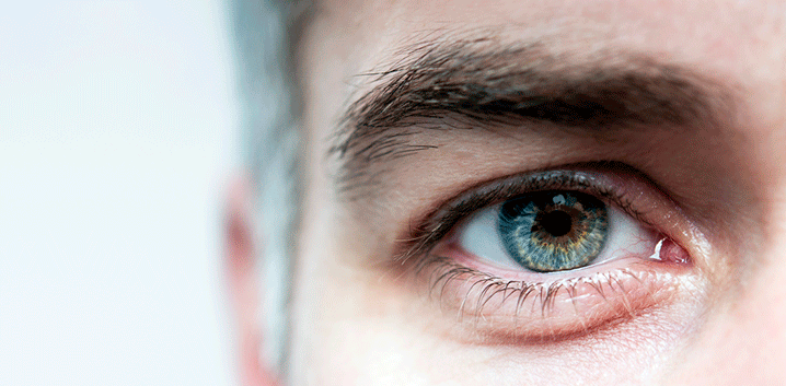 Ultralase Laser Eye Surgery